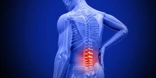 Acupuncture for ankylosing spondylitis